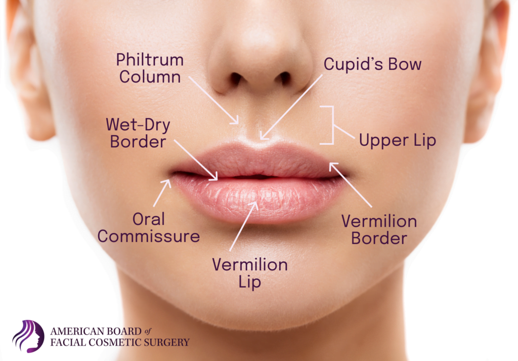 Dermal filler for Cupid's bow - Cosmetic Connection